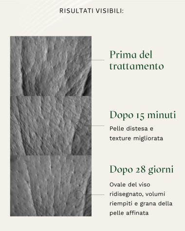 MIRABILIFT 10+ Siero antirughe efficace in 15 minuti con Picnogenolo® e Acido Ialuronico - 30 ml