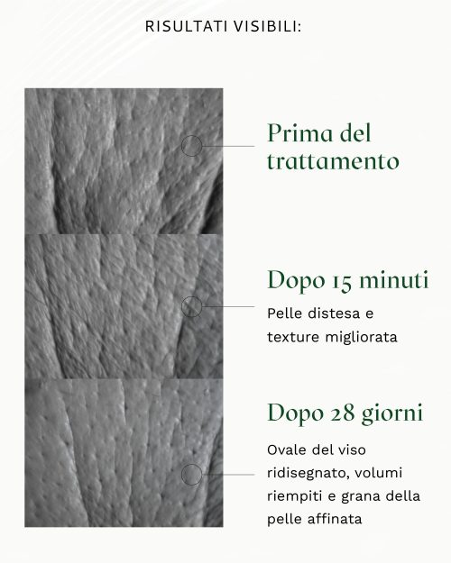 MIRABILIFT 10+ Siero antirughe efficace in 15 minuti con Picnogenolo® e Acido Ialuronico - 30 ml